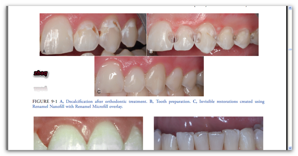 dent1201201.png